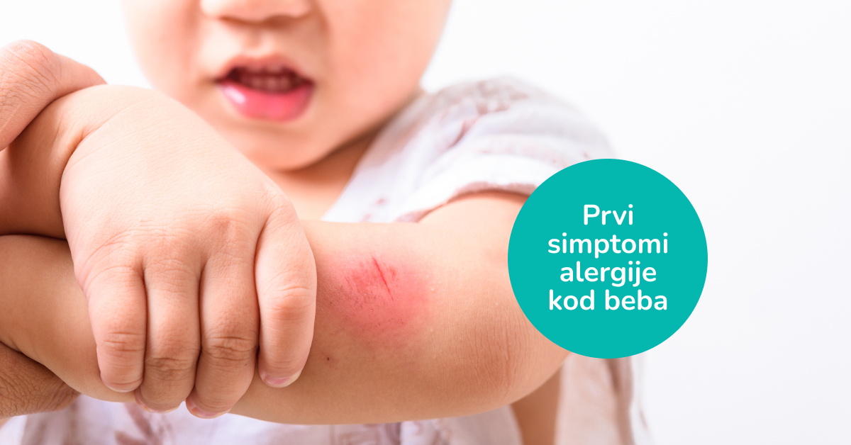 Prvi simptomi alergije kod beba: Kako prepoznati i reagovati? - Bebicol